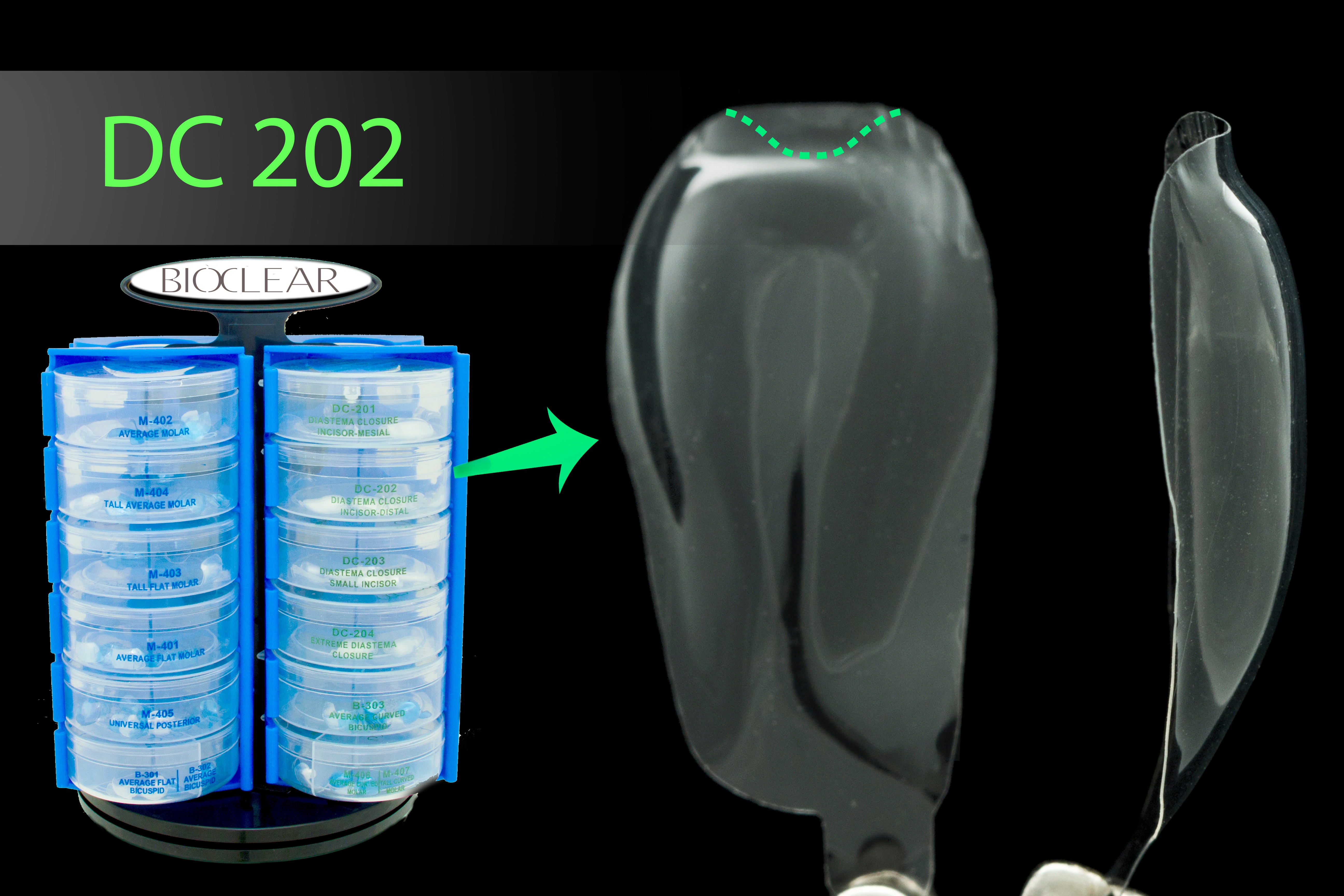 Closing the Gap in Direct Dentistry Treating Black Triangles Optident